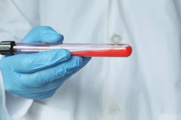 Laboratuvar teknisyeni elinde kan testi tüpü tutuyor. — Stok fotoğraf
