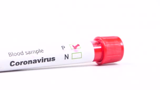 Primer plano del tubo de análisis de sangre del virus corona sobre fondo blanco — Vídeo de stock