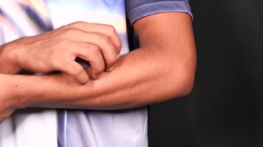 Kaşındıran deriden muzdarip bir adam. Yaklaş..