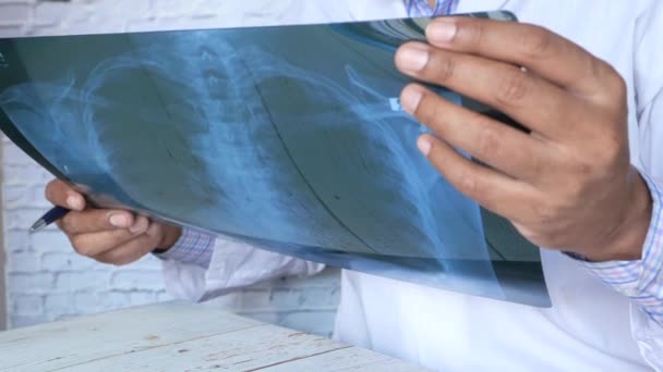 Доктор проводит анализ рентгеновской фотографии, крупным планом — стоковое видео