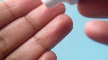  İnsan eli cilde antiseptik krem sürüyor.