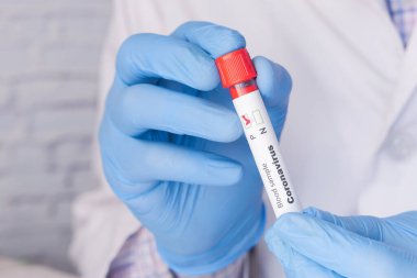 Ellerinde korona kan test tüpü ve fotokopi alanı olan tıbbi eldivenler. 