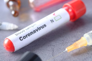 Siyah arkaplanda Corona virüsünün kan test tüpünü kapatın. 