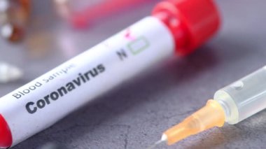Siyah arkaplanda Corona virüsünün kan test tüpünü kapatın. 