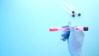 Kan testi tüpü tutan mavi tıbbi eldivenler. 