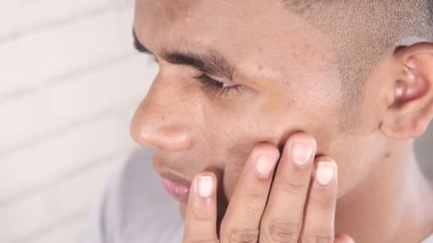 Zblízka mladého muže tvář s kožním problémem . — Stock video