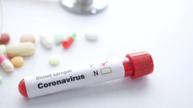 Beyaz arkaplanda Corona virüsünün kan test tüpünü kapat 