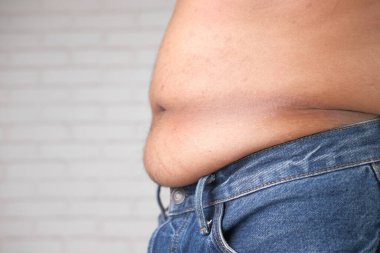  Aşırı göbek yağlı, aşırı kilolu genç adam.