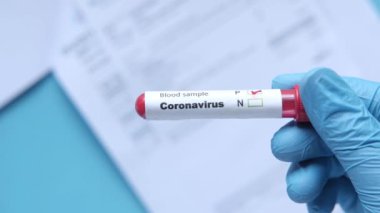 Kan testi tüpü ve sağlık raporlarını tutan mavi eldivenleri masaya koy. 