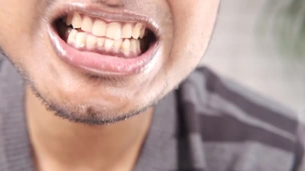 Fiatal férfi nyitott nyereg ellenőrzi a fogait — Stock videók