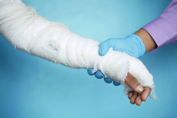 Mano del médico en guantes con la mano dolorosa lesionada con vendaje —  Fotos de Stock