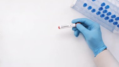 Kan testi tüpü tutan mavi tıbbi eldivenleri verin. 