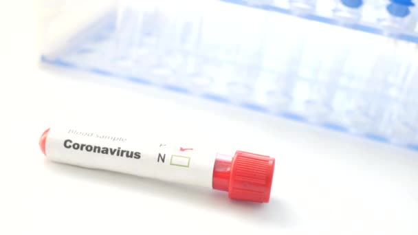 Primer plano del tubo de análisis de sangre del virus corona sobre fondo blanco — Vídeos de Stock