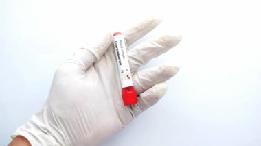 Beyaz arka planda kan testi tüpü tutan mavi tıbbi eldivenler. 