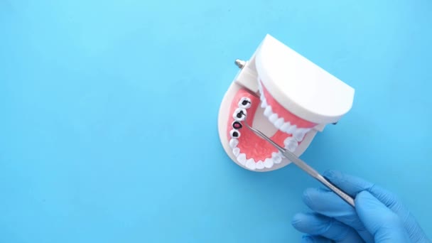 Dentist in blue gloves analysis plastic dental teeth model, — Stock Video