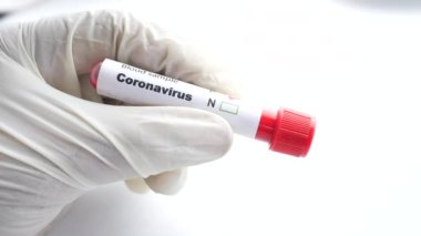 Kan testi tüpü tutan mavi tıbbi eldivenler. 