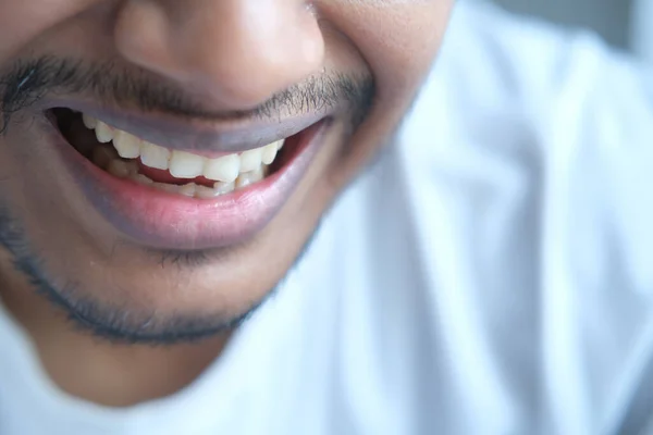 Młody człowiek otwarte zamontować sprawdzanie jego zęby — Zdjęcie stockowe