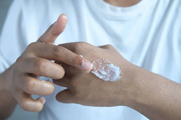 Man hand applying petroleum jelly on skin — Stock Photo, Image