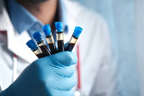 Χέρι σε μπλε ιατρικά γάντια που κρατούν λευκό σωλήνα εξέταση αίματος sited — Φωτογραφία Αρχείου