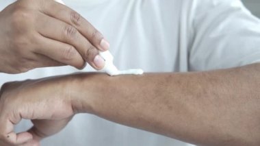 Antibiyotik kremi süren bir adam.