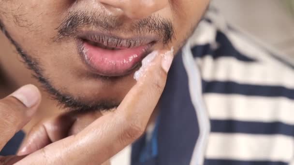 Primo piano del giovane che applica gelatina di petrolio sul labbro — Video Stock