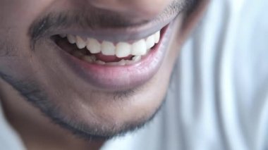 Genç adam dişlerini kontrol etmek için atlarını açıyor. 