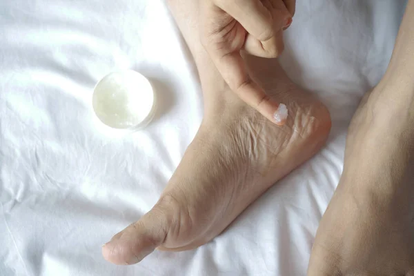 Wanita menggunakan minyak jelly ke kaki di tempat tidur — Stok Foto