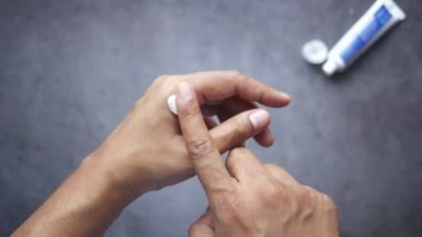 Antibiyotik kremi süren bir adam.