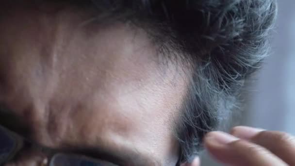 Haarausfall Konzept mit Mann überprüft seine Haare — Stockvideo