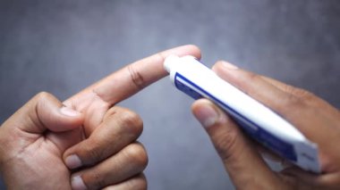 Antibiyotik kremi süren bir adam.