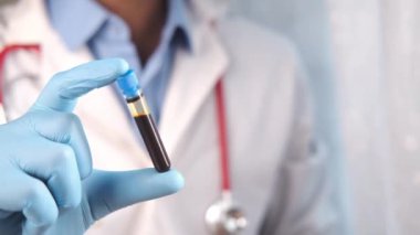 Kan testi tüpü tutan mavi tıbbi eldivenler. 