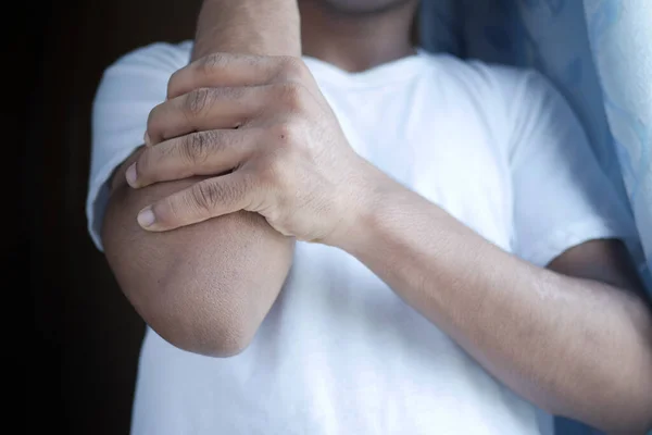 Hombre con dolor de codo, concepto de alivio del dolor. —  Fotos de Stock