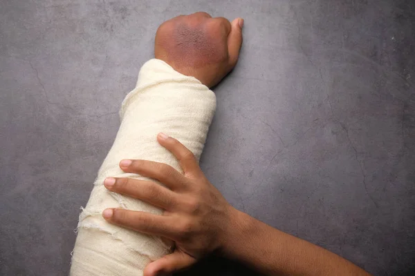 Injured painful hand with bandage — Stock Photo, Image