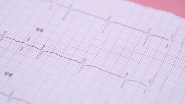 Detailaufnahme des Cardio-Diagramms auf rosa Hintergrund — Stockvideo