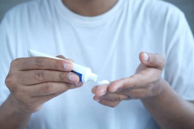 Antibiyotik kremi süren bir adam.