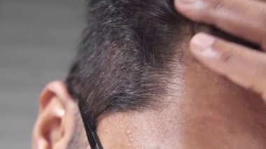 Saçlar, erkeklerin saçlarını kontrol etmesiyle dökülür. 
