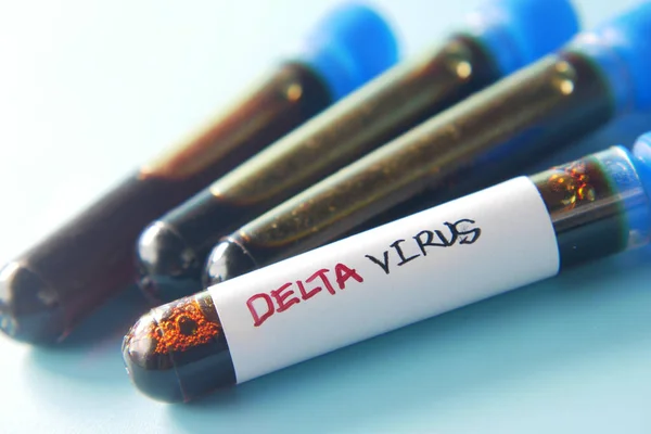 Mavi arka planda delta corona virüs kan test tüpünü kapatın. 