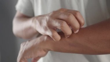 Kaşınan deriyi kontrol etmek için etkili ipuçları öğren ve bugün rahatla..