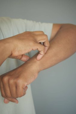 Ellerinde kaşıntı var. .