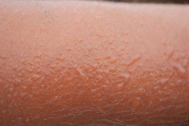 Su damlacıklı deri fiziksel aktivite ve ısının etkilerini gösteriyor..