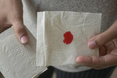 Kişi tarafından tutulan bir tuvalet kağıdındaki kan lekesi.