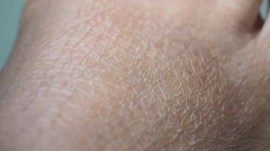 Ayaktaki kurumuş deri dokusunun detaylı yakın çekimi.