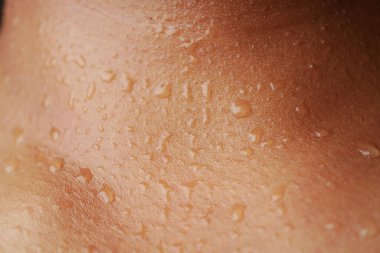 Sıcak havalarda, egzersizden sonra derinin üzerinde terler...