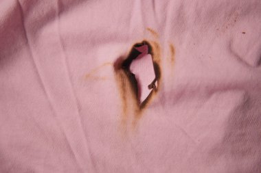Pembe kumaşı yakan bir delik ısıdan kaynaklanan hasarı gösteriyor..