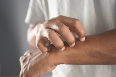 Bir insan ışığın içinde ayakta dururken kolunu kaşıyor..