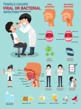 Tonsils caused viral or bacterial infection clipart
