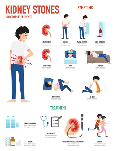 Calcoli Renali Infografica Vettoriale Illustrazione — Vettoriale Stock