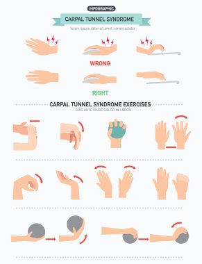 Carpal tunnel syndrome infographic clipart