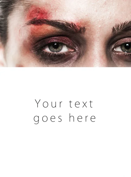 Beaten up girl close-up card — Stock Photo, Image
