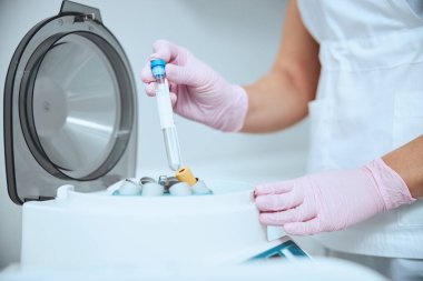 Doktor serumu kozmetik bir işlem için hazırlıyor.